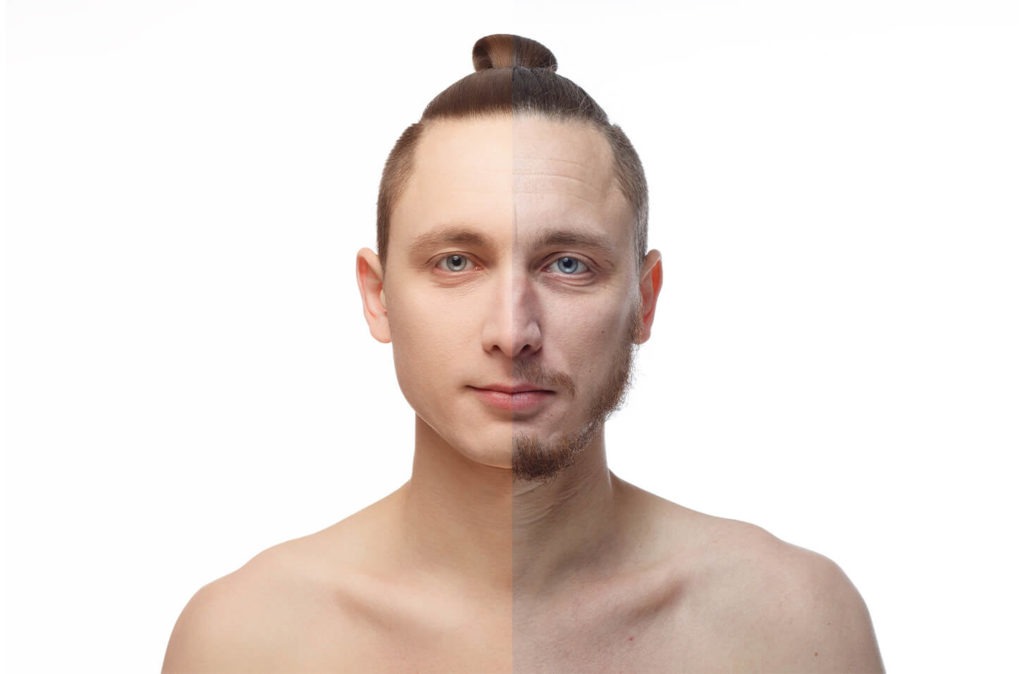 man profile before and after dermaplaning, split face